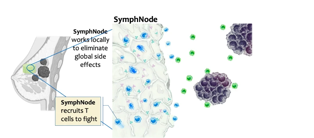 Diagram: SymphNode works locally beside the tumor, recruiting T cells into the scaffold.